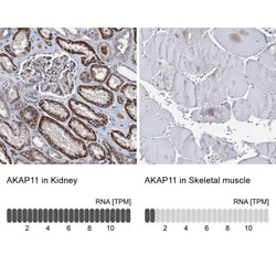 AKAP11 Antibody, Novus Biologicals 25 &mu;L | Buy Online | Novus Biologicals | Fisher Scientific